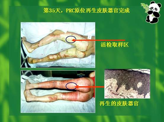 mg冰球突破豪华版(试玩)官方网站