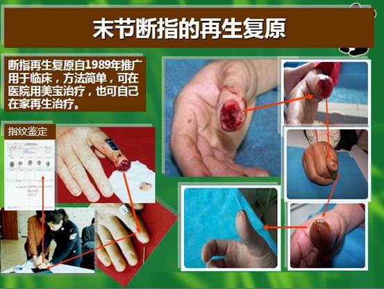 mg冰球突破豪华版(试玩)官方网站
