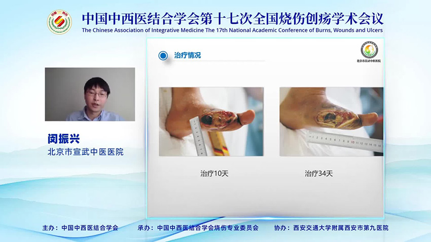 mg冰球突破豪华版(试玩)官方网站