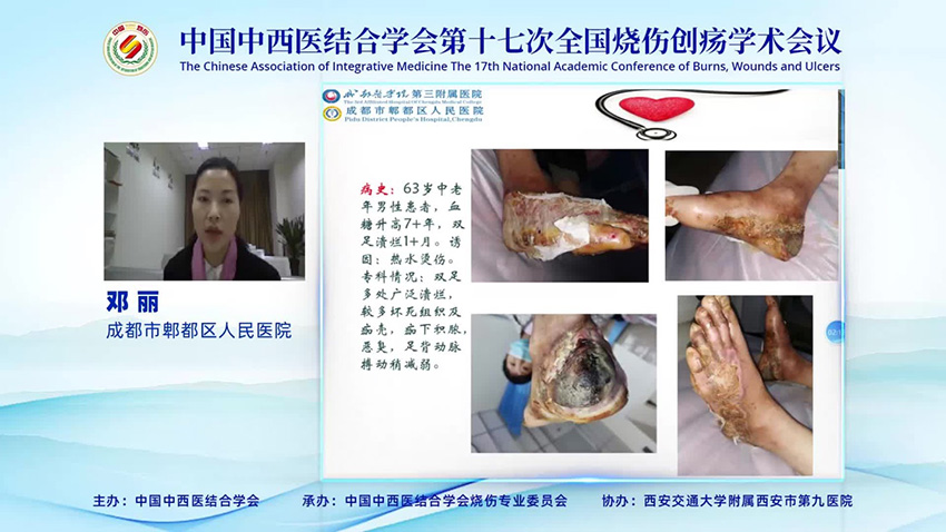 mg冰球突破豪华版(试玩)官方网站