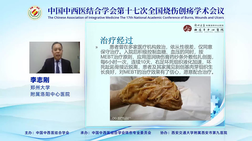 mg冰球突破豪华版(试玩)官方网站