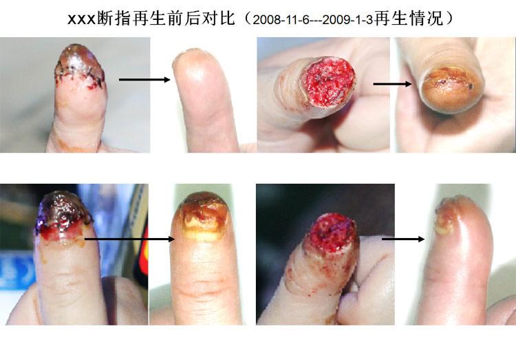 mg冰球突破豪华版(试玩)官方网站