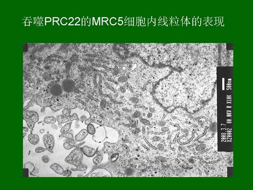 mg冰球突破豪华版(试玩)官方网站