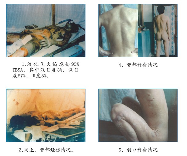 mg冰球突破豪华版(试玩)官方网站