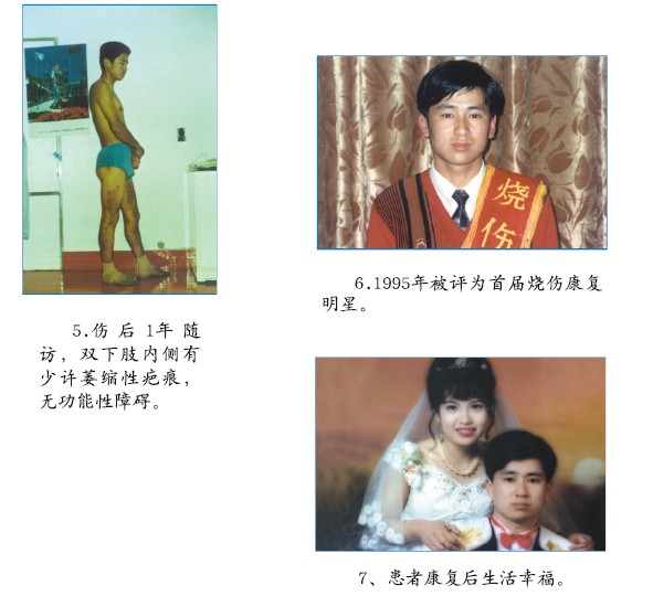 mg冰球突破豪华版(试玩)官方网站