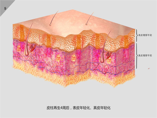 mg冰球突破豪华版(试玩)官方网站