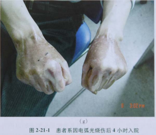 20113214244162